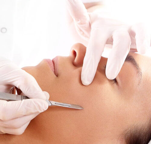 Dermaplaning